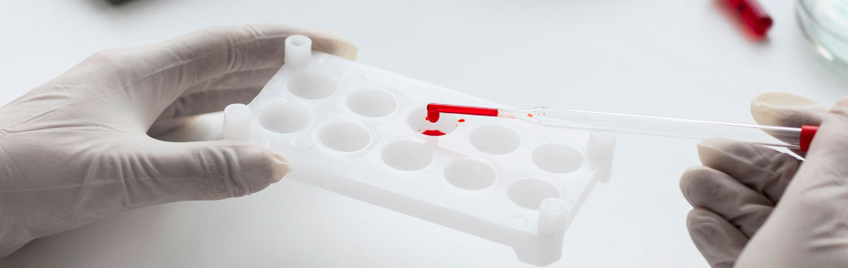 Когда нужно сдать кровь Когда нужно сдать кровь