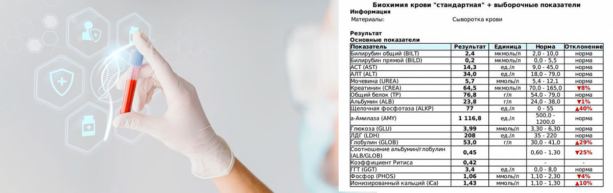 Анализ крови Анализ крови