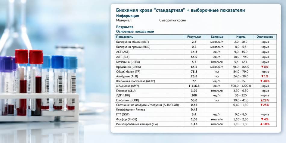 Когда нужно сдать кровь Когда нужно сдать кровь