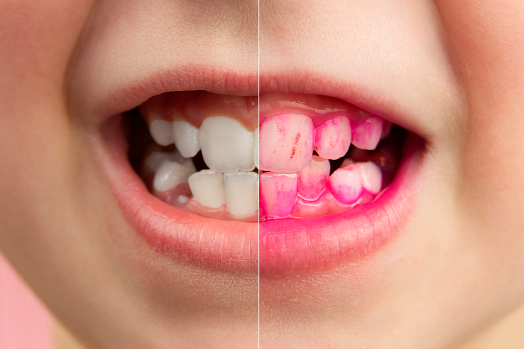 Причины изменения цвета эмали зубов