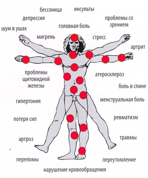 Магнитотерапия - польза и вред