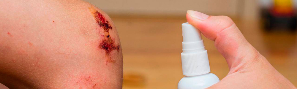 Обработка ран хлоргексидином в виде аэрозоля Обработка ран хлоргексидином в виде аэрозоля