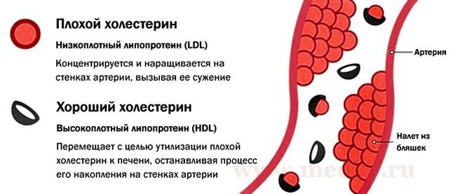 Определение уровня холестерина и факторы риска