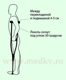 Как подобрать подмышечные костыли